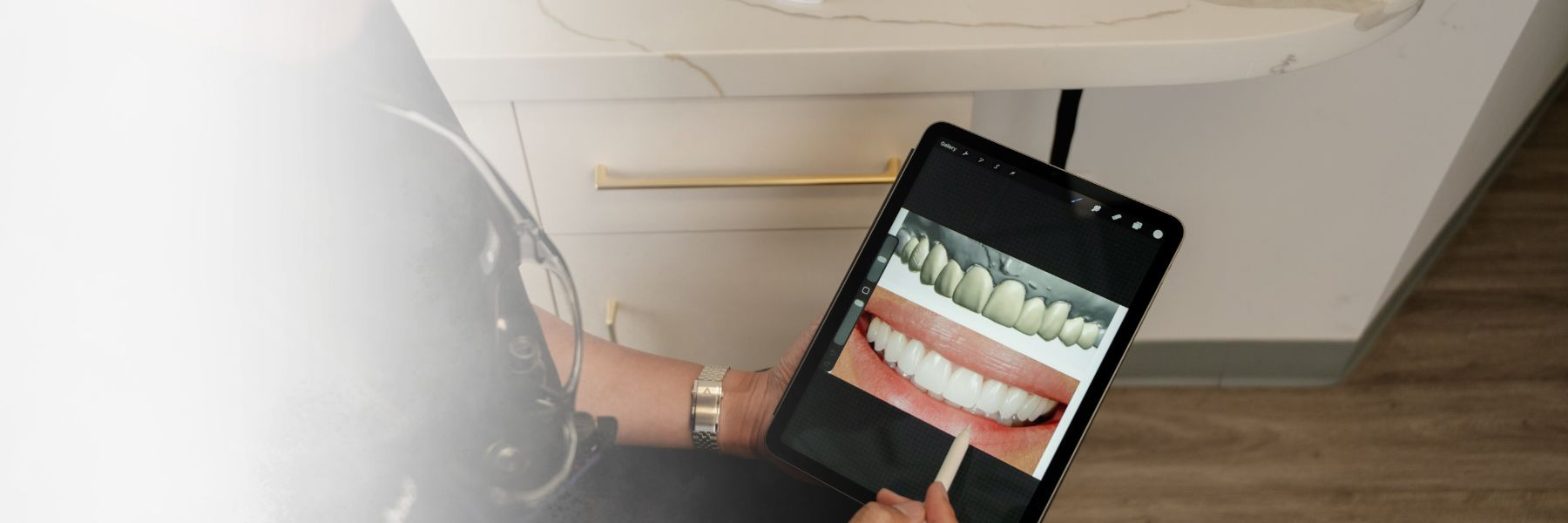 Full Smile Makeovers | Dentist